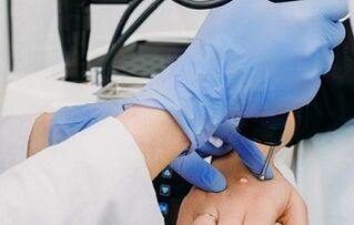 modi per rimuovere le verruche